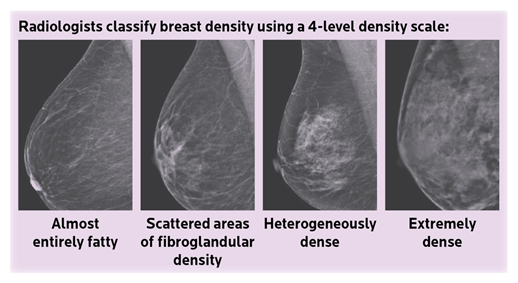 Breast Density Scale