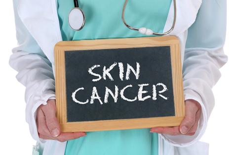 Tips to Checking Your Skin for Skin Cancer